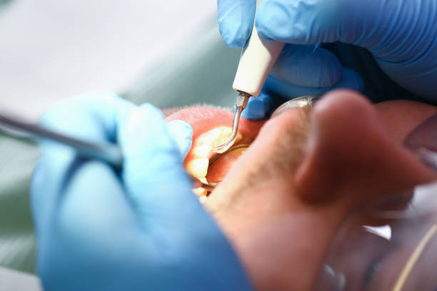 Best Knocked-Out Tooth Emergency  in Bellevue, IA