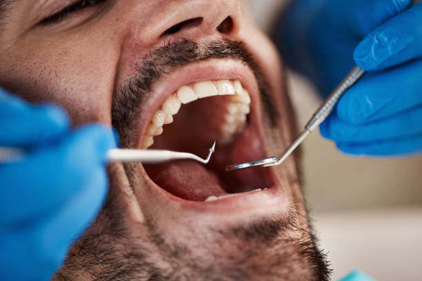 Best Emergency Gum Pain Relief  in Bellevue, IA